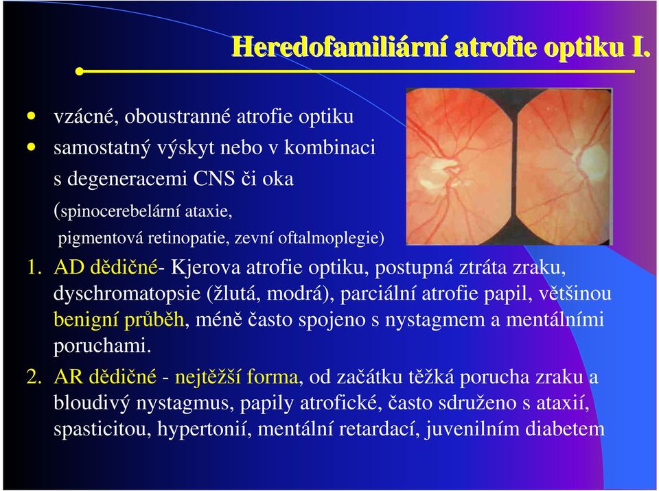 zevní oftalmoplegie) 1.