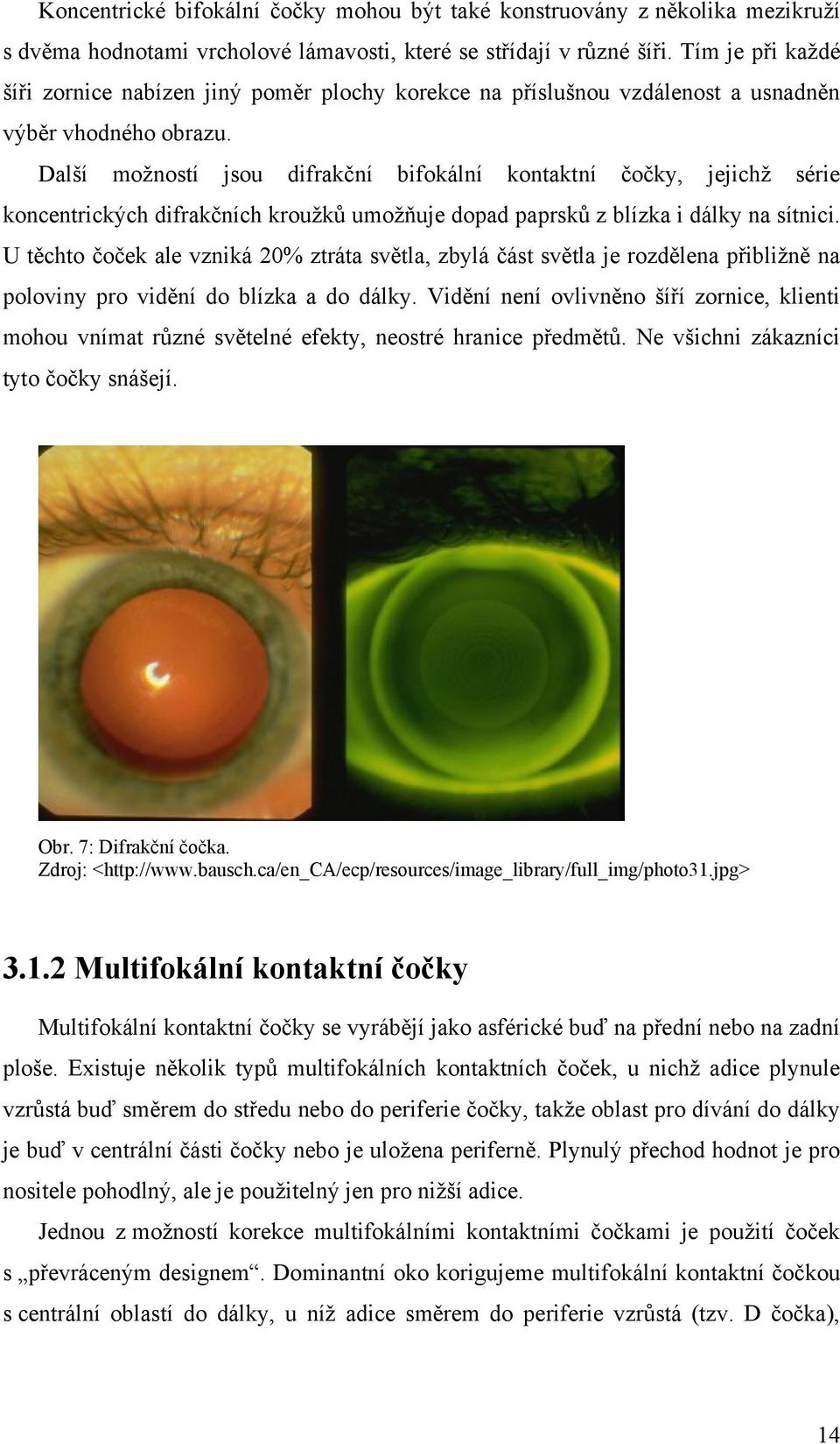 Další moţností jsou difrakční bifokální kontaktní čočky, jejichţ série koncentrických difrakčních krouţků umoţňuje dopad paprsků z blízka i dálky na sítnici.