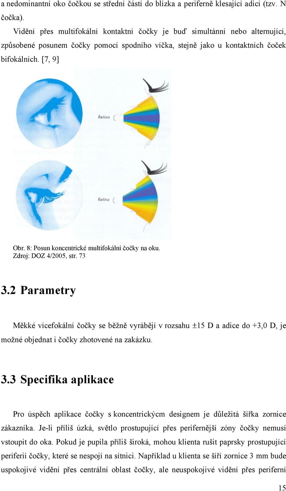 8: Posun koncentrické multifokální čočky na oku. Zdroj: DOZ 4/2005, str. 73 3.