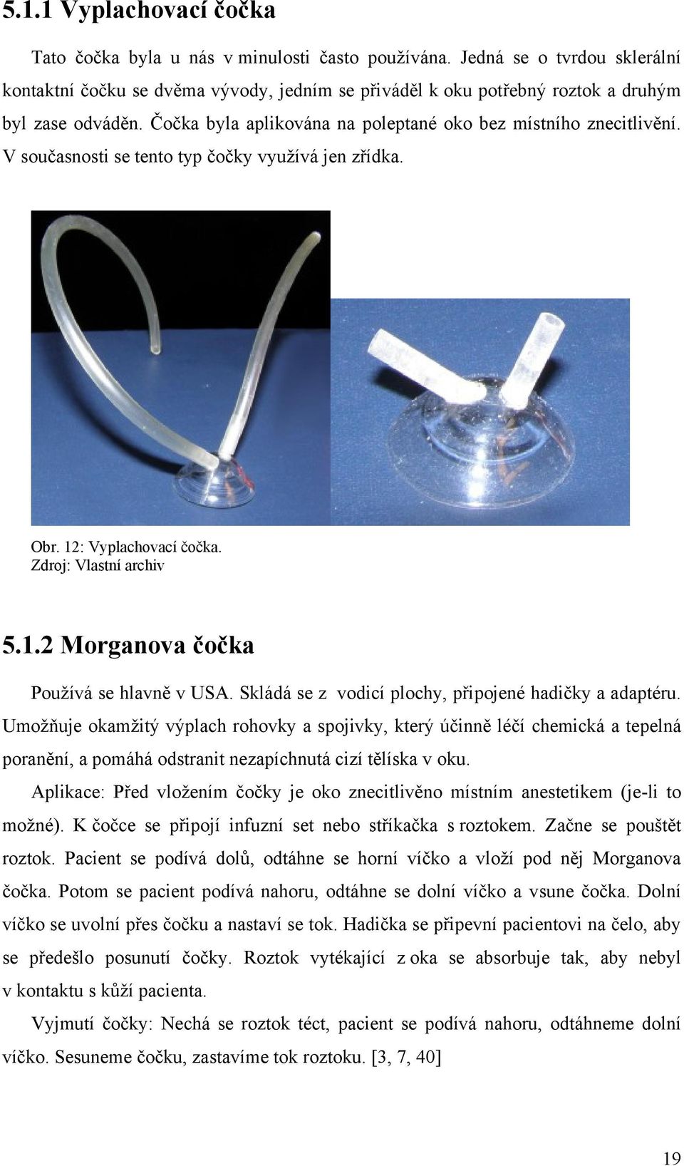V současnosti se tento typ čočky vyuţívá jen zřídka. Obr. 12: Vyplachovací čočka. Zdroj: Vlastní archiv 5.1.2 Morganova čočka Pouţívá se hlavně v USA.