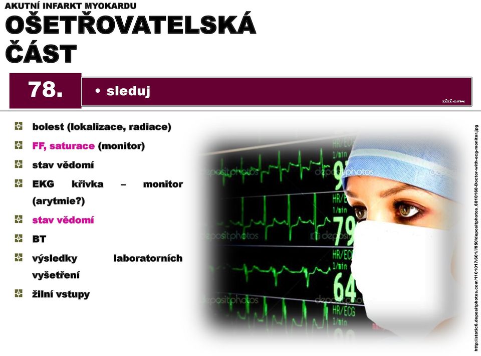 jpg AKUTNÍ INFARKT MYOKARDU OŠETŘOVATELSKÁ ČÁST 78.