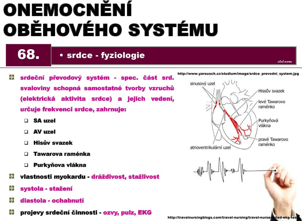 yarousch.cz/studium/image/srdce_prevodni_system.