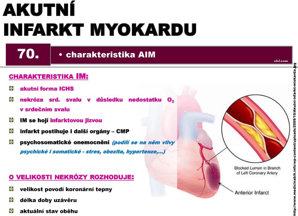 svalu v důsledku nedostatku O 2 v srdečním svalu IM se hojí infarktovou jizvou infarkt postihuje i další orgány CMP