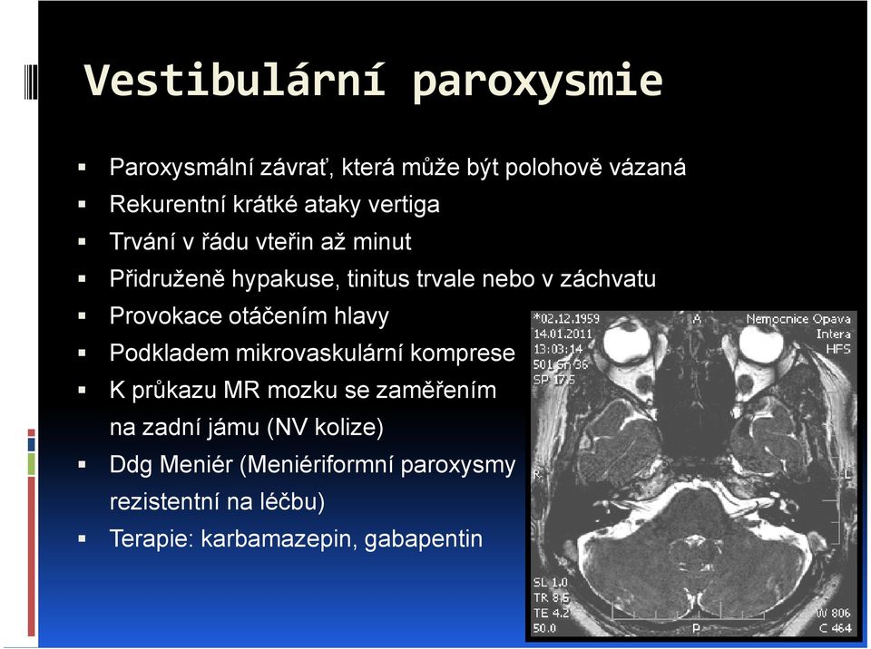 otáčením hlavy Podkladem mikrovaskulární komprese K průkazu MR mozku se zaměřením na zadní jámu (NV