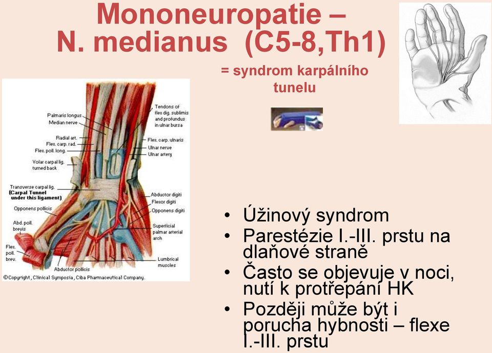 syndrom Parestézie I.-III.