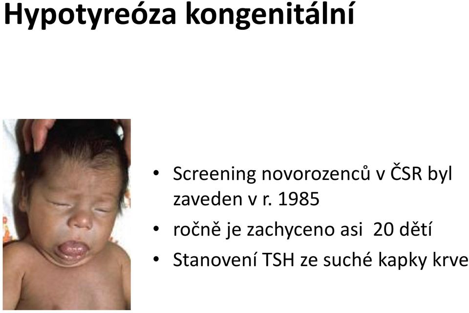 1985 ročně je zachyceno asi 20