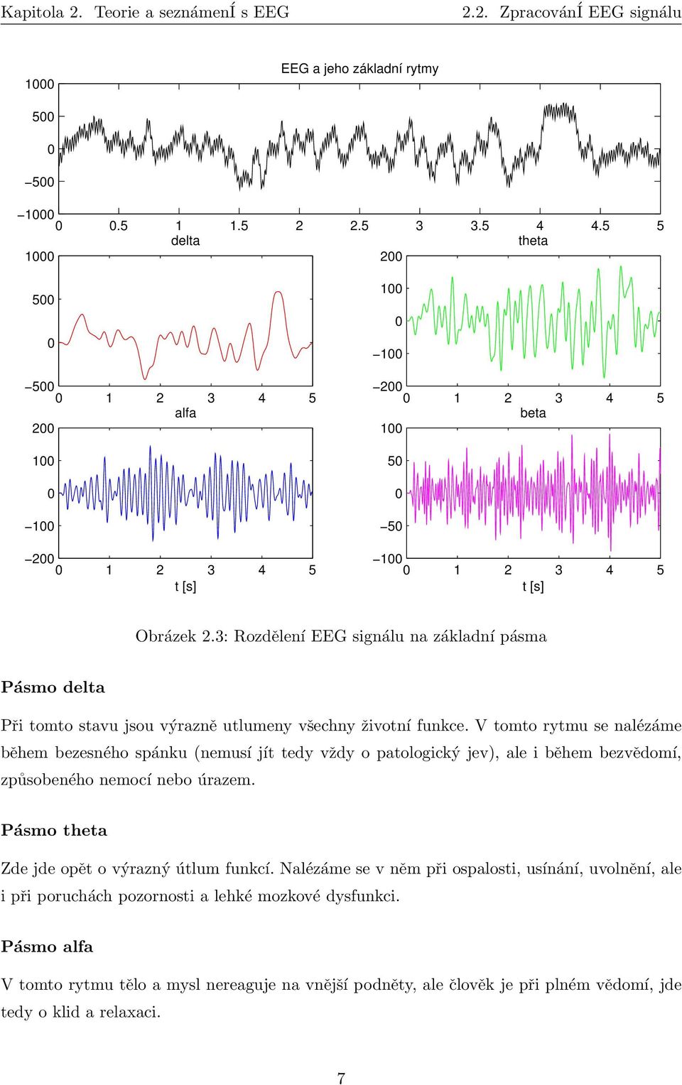 3: Rozdělení EEG signálu na základní pásma Pásmo delta Při tomto stavu jsou výrazně utlumeny všechny životní funkce.