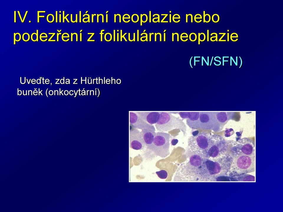 neoplazie Uveďte, zda z