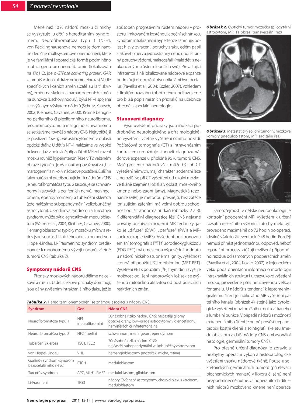 (lokalizován na 17q11.2, jde o GTPase activating protein, GAP, zahrnutý v signální dráze onkoproteinu ras).