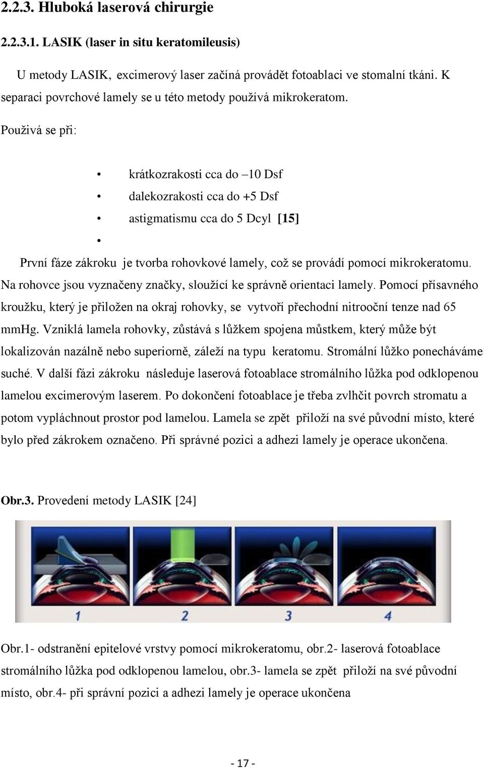 Pouţivá se při: krátkozrakosti cca do 10 Dsf dalekozrakosti cca do +5 Dsf astigmatismu cca do 5 Dcyl [15] První fáze zákroku je tvorba rohovkové lamely, coţ se provádí pomocí mikrokeratomu.
