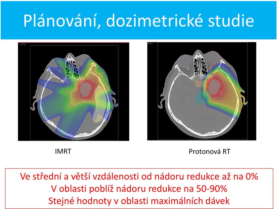 redukce až na 0% V oblasti poblíž nádoru