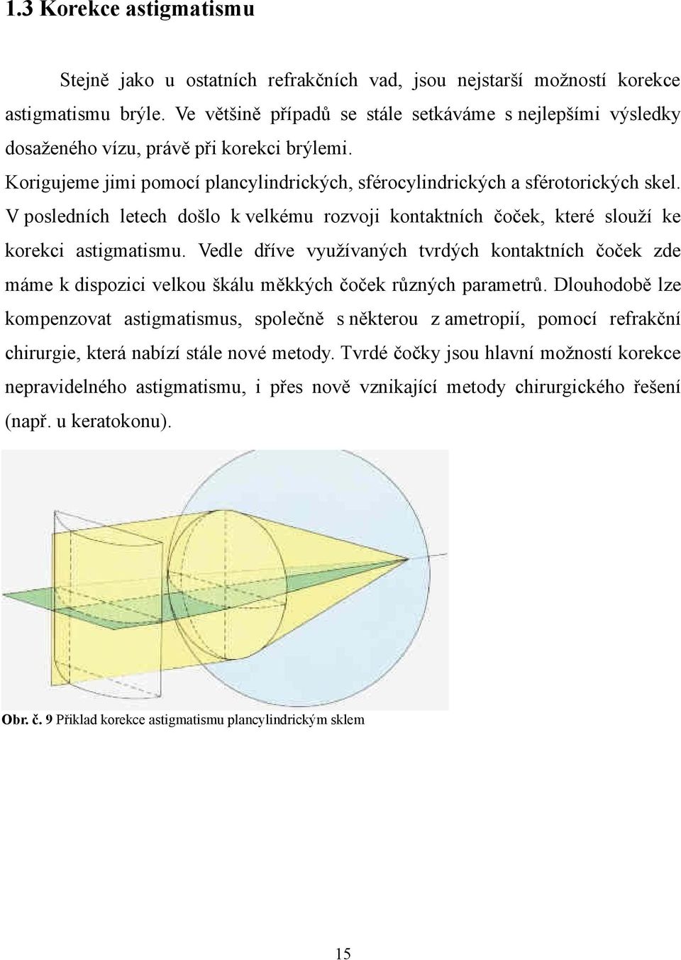 V posledních letech došlo k velkému rozvoji kontaktních čoček, které slouží ke korekci astigmatismu.