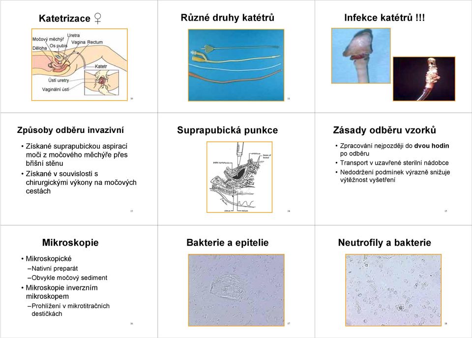 na močových cestách Suprapubická punkce Zásady odběru vzorků Zpracování nejpozději do dvou hodin po odběru Transport v uzavřené sterilní nádobce