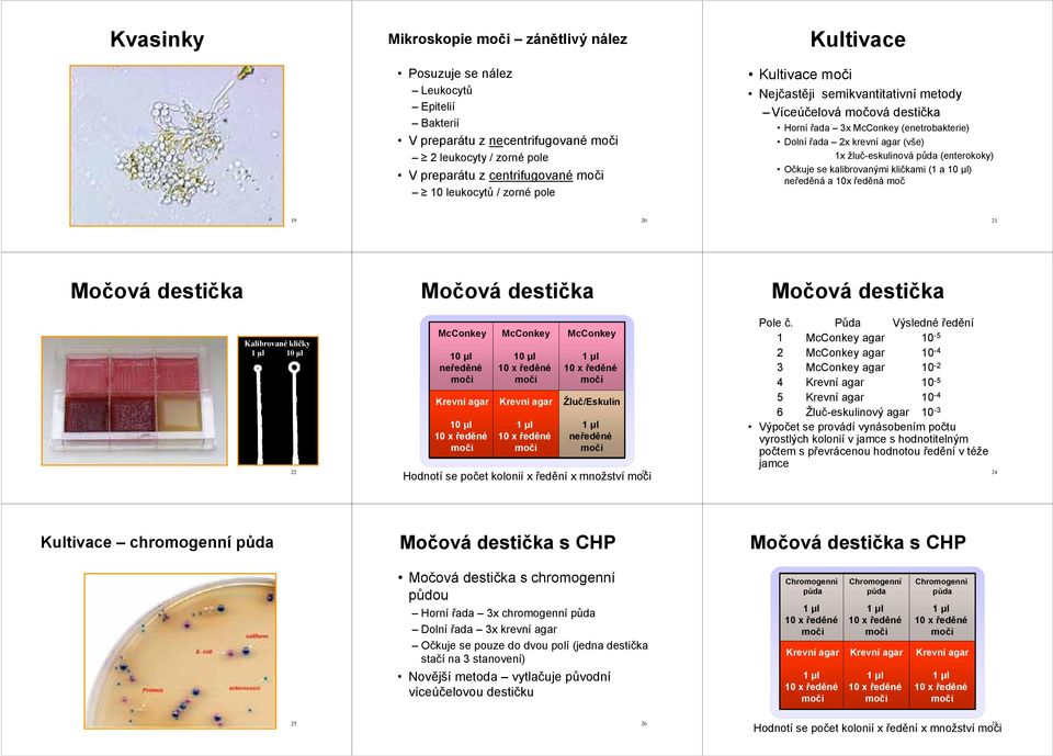 se kalibrovanými kličkami (1 a 10 µl) neředěná a 10x ředěná moč 19 20 21 Močová destička Močová destička Močová destička Kalibrované kličky 10 µl 22 McConkey 10 µl neředěné 10 µl McConkey 10 µl