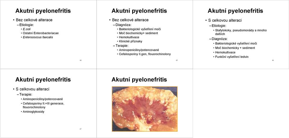 Terapie: Aminopeniciliny/potencované Cefalosporiny II.