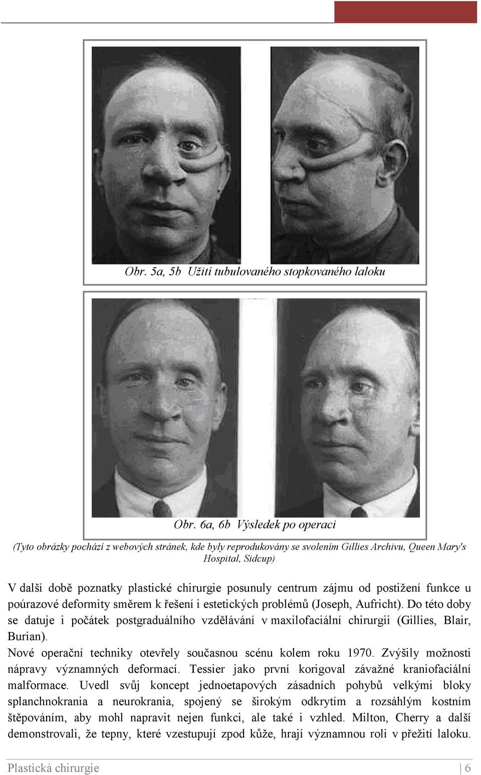 posunuly centrum zájmu od postižení funkce u poúrazové deformity směrem k řešení i estetických problémů (Joseph, Aufricht).