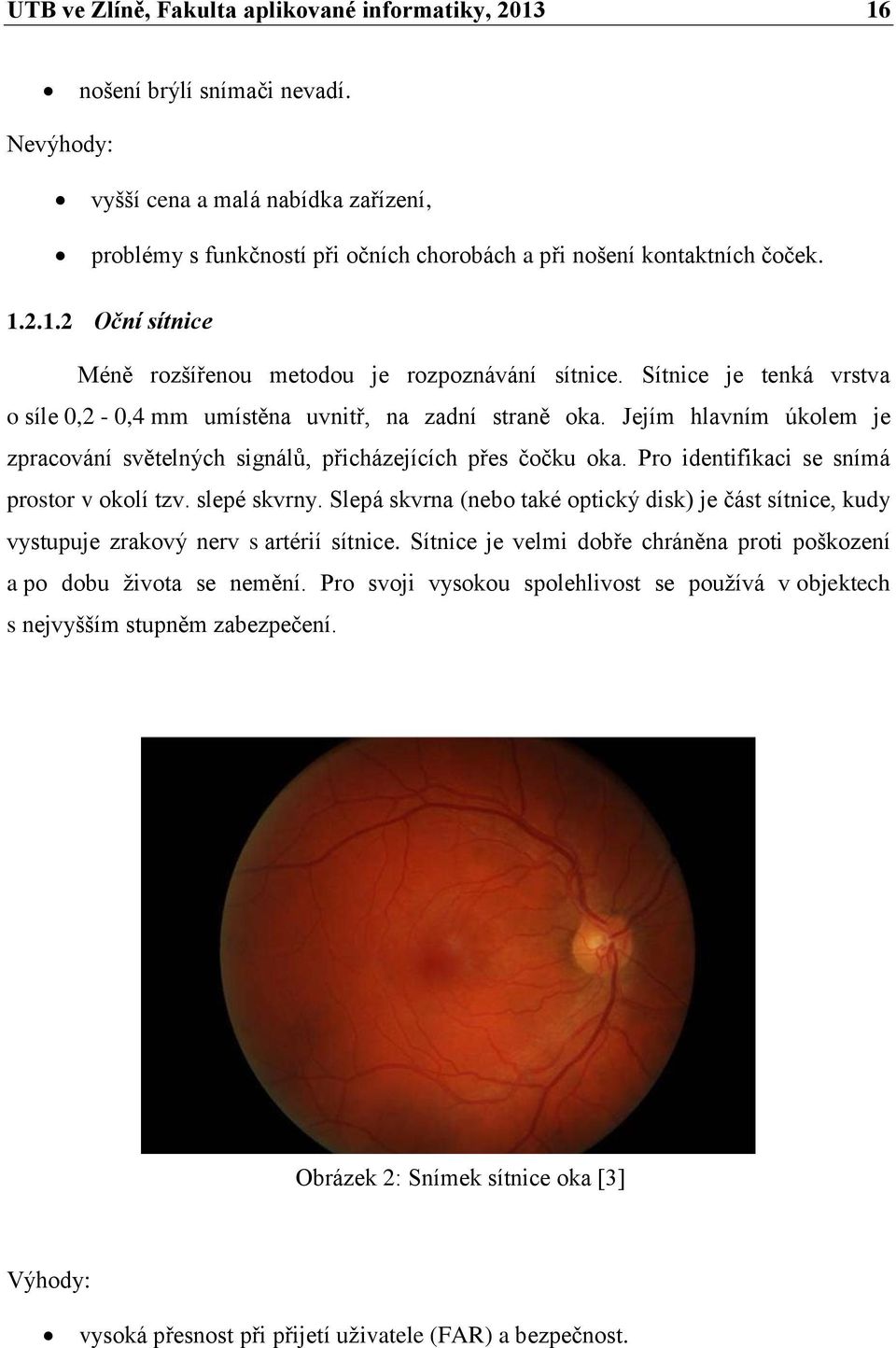 Sítnice je tenká vrstva o síle 0,2-0,4 mm umístěna uvnitř, na zadní straně oka. Jejím hlavním úkolem je zpracování světelných signálů, přicházejících přes čočku oka.