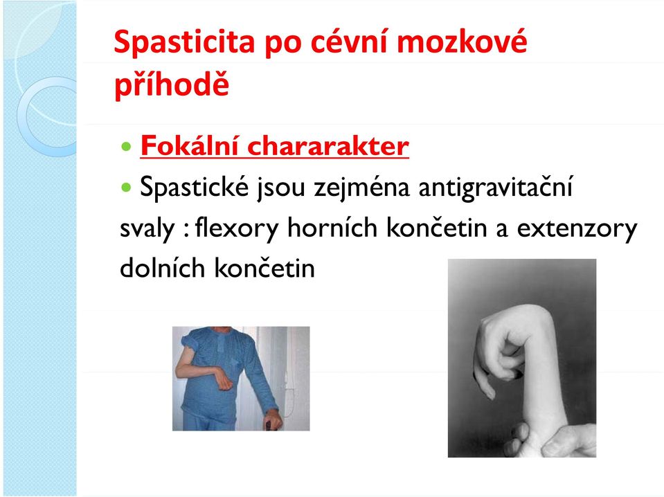 antigravitační Spastické jsou zejména