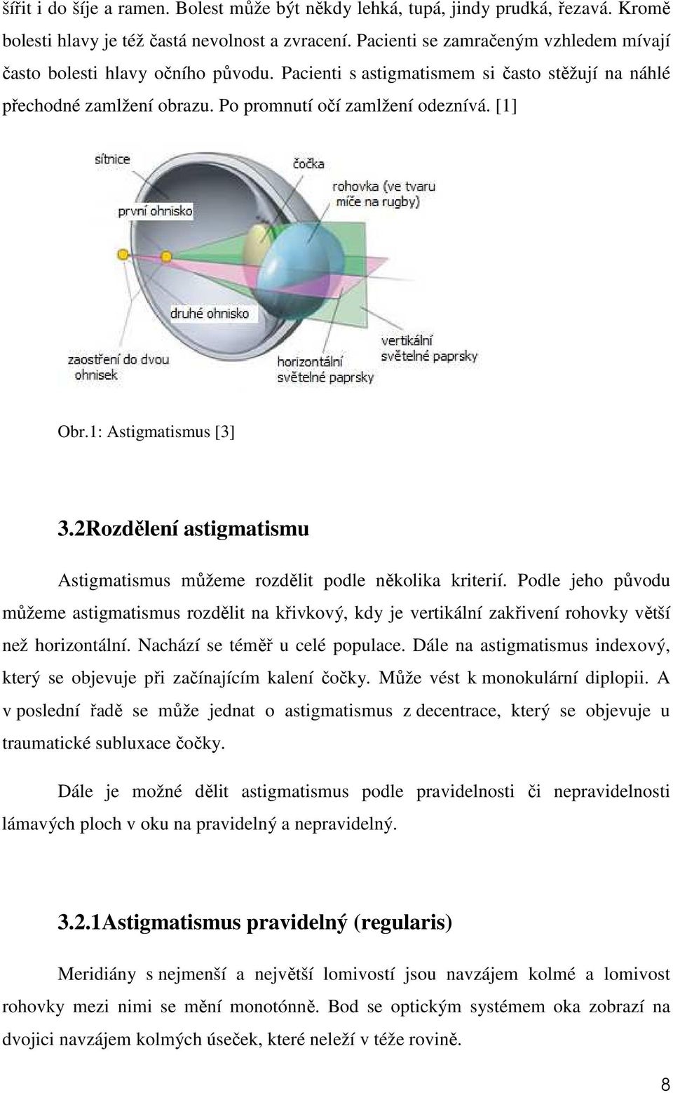 1: Astigmatismus [3] 3.2Rozdělení astigmatismu Astigmatismus můžeme rozdělit podle několika kriterií.