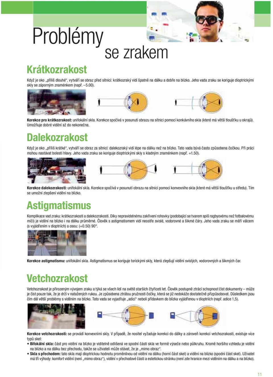 Korekce spočívá v posunutí obrazu na sítnici pomocí konkávního skla (které má větší tloušťku u okrajů). Umožňuje dobré vidění až do nekonečna.