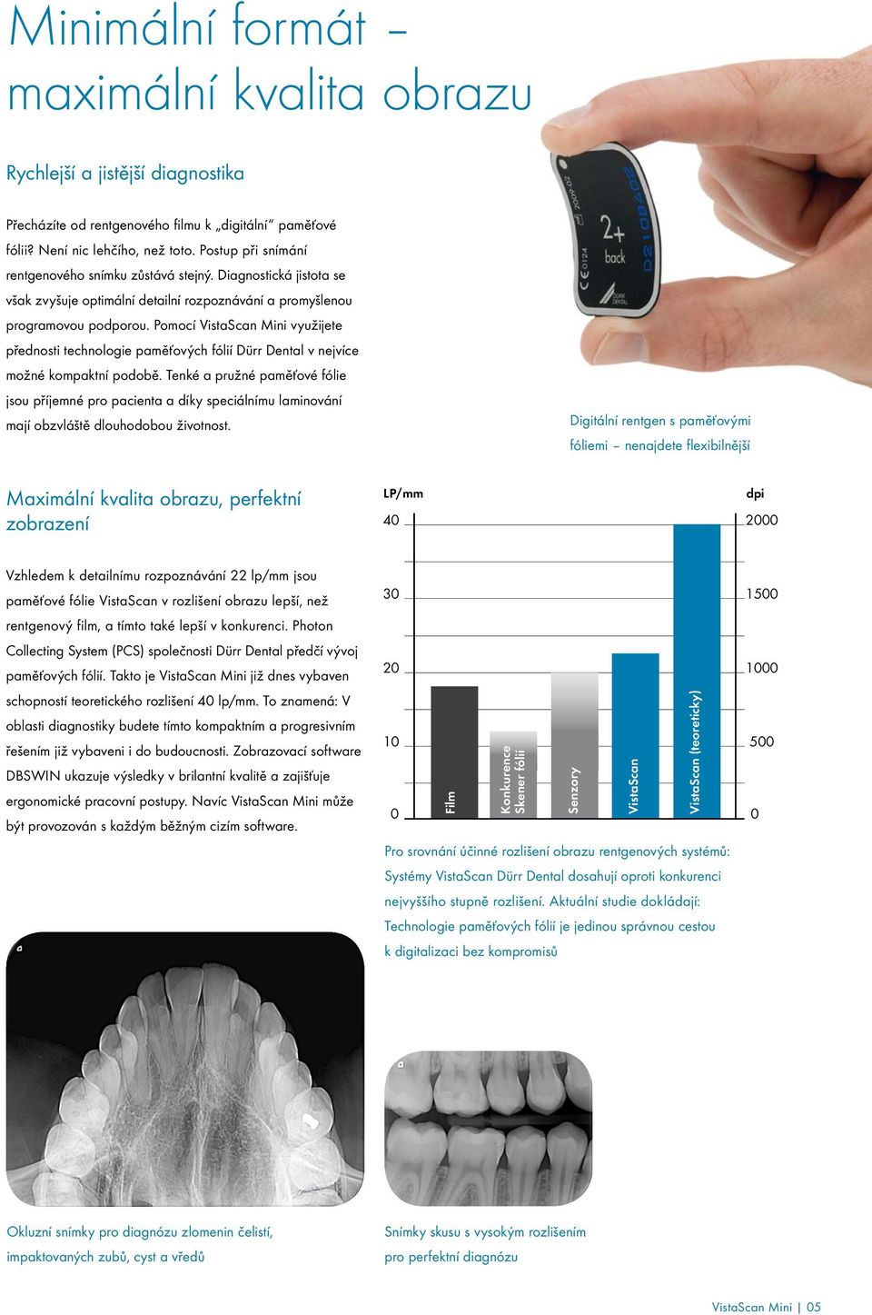 Pomocí VistaScan Mini využijete přednosti technologie paměťových fólií Dürr Dental v nejvíce možné kompaktní podobě.