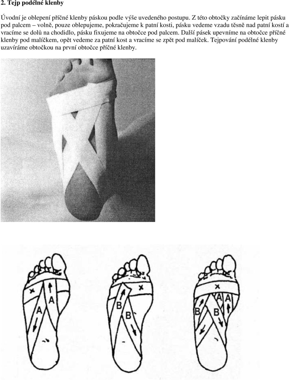 nad patní kostí a vracíme se dolů na chodidlo, pásku fixujeme na obtočce pod palcem.