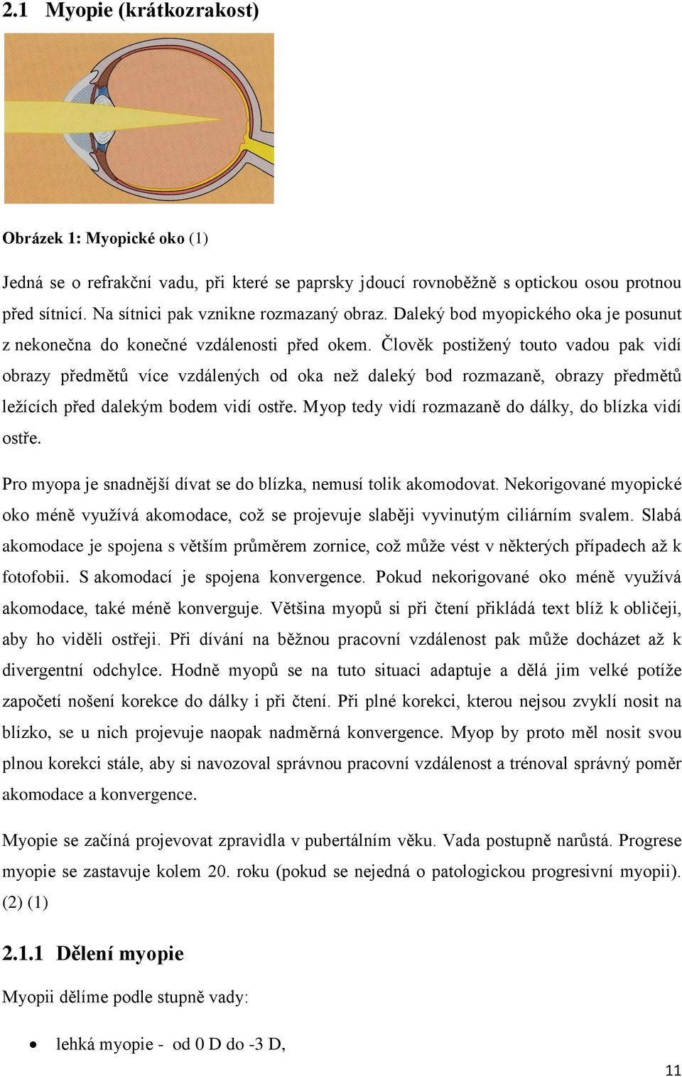 Člověk postižený touto vadou pak vidí obrazy předmětů více vzdálených od oka než daleký bod rozmazaně, obrazy předmětů ležících před dalekým bodem vidí ostře.