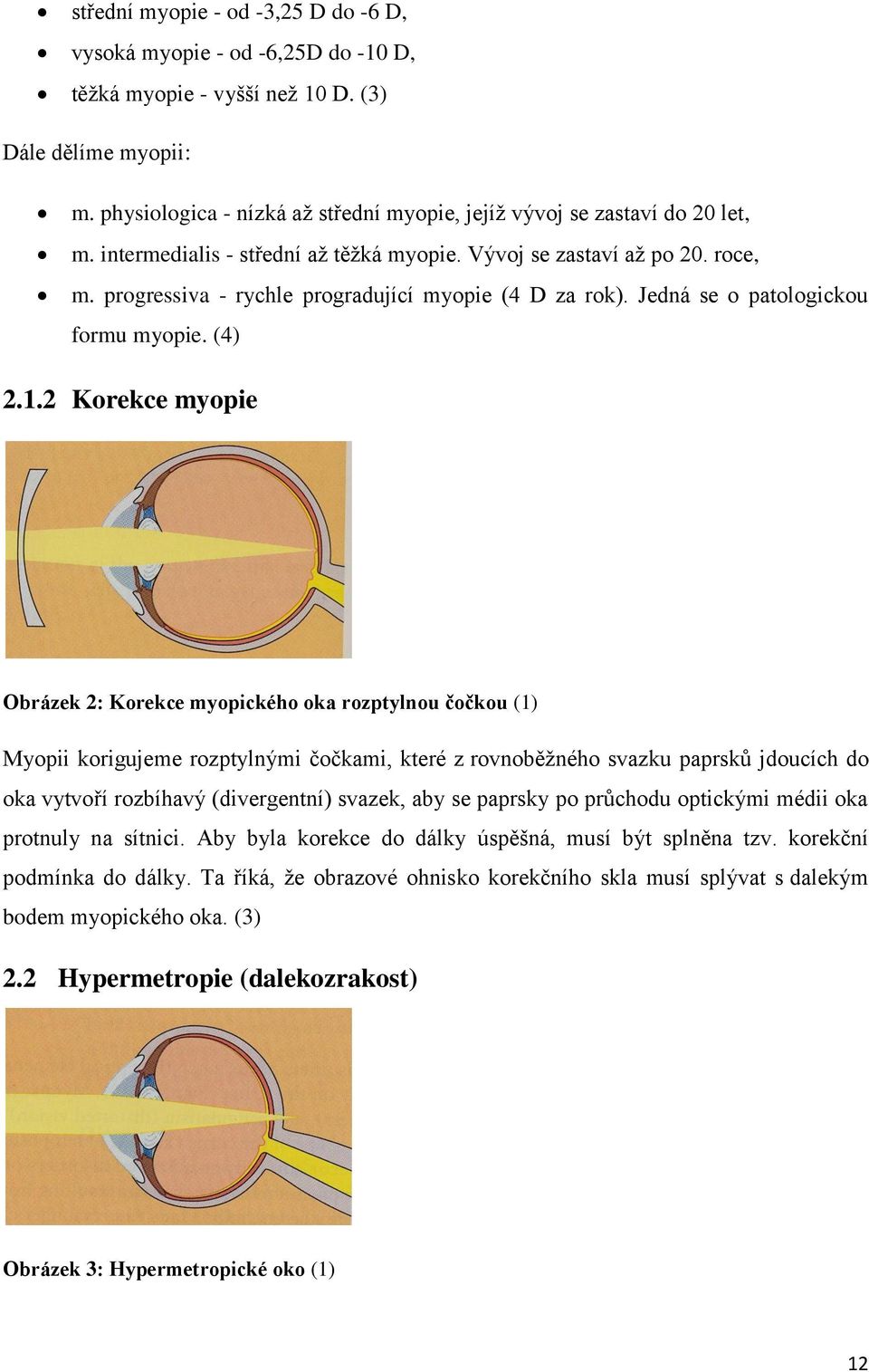 progressiva - rychle progradující myopie (4 D za rok). Jedná se o patologickou formu myopie. (4) 2.1.