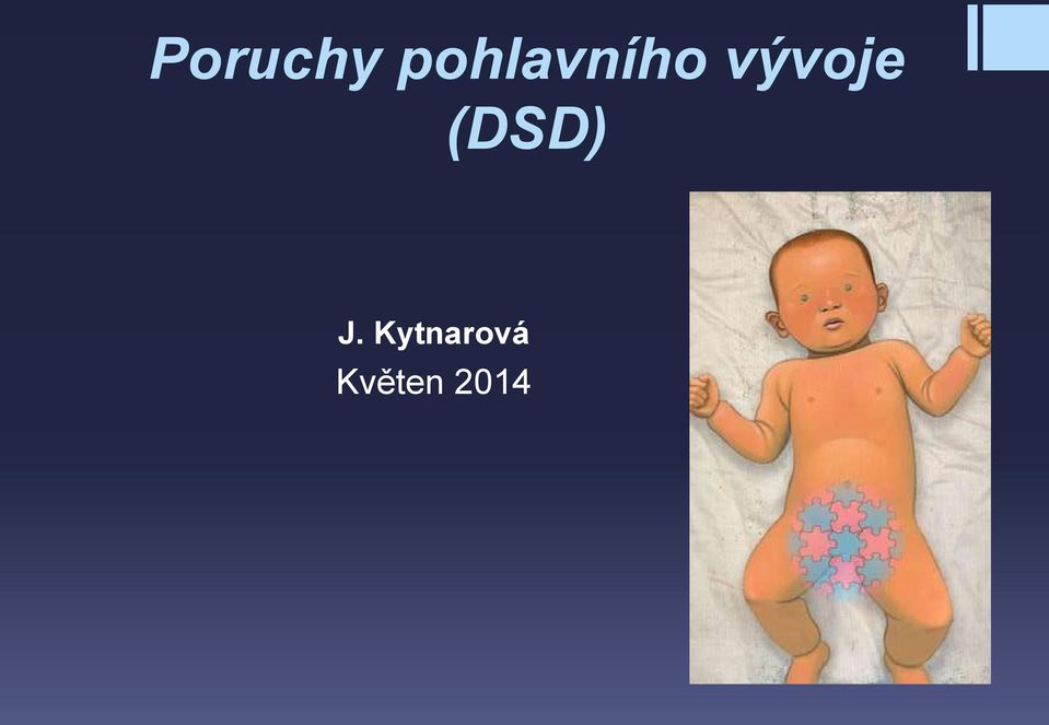 vývoje (DSD)