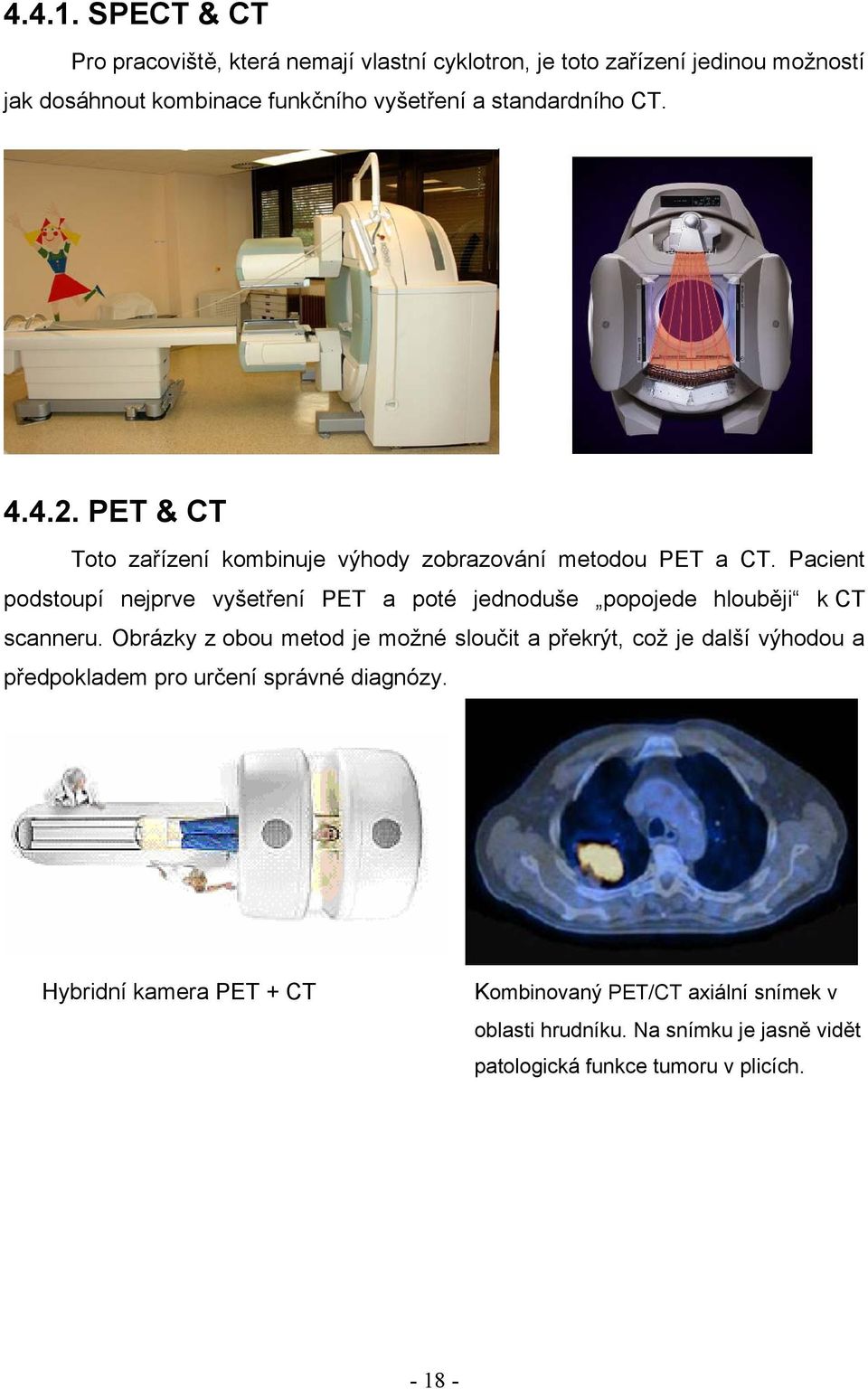 standardního CT. 4.4.2. PET & CT Toto zařízení kombinuje výhody zobrazování metodou PET a CT.