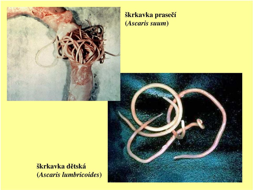 lumbricoides)