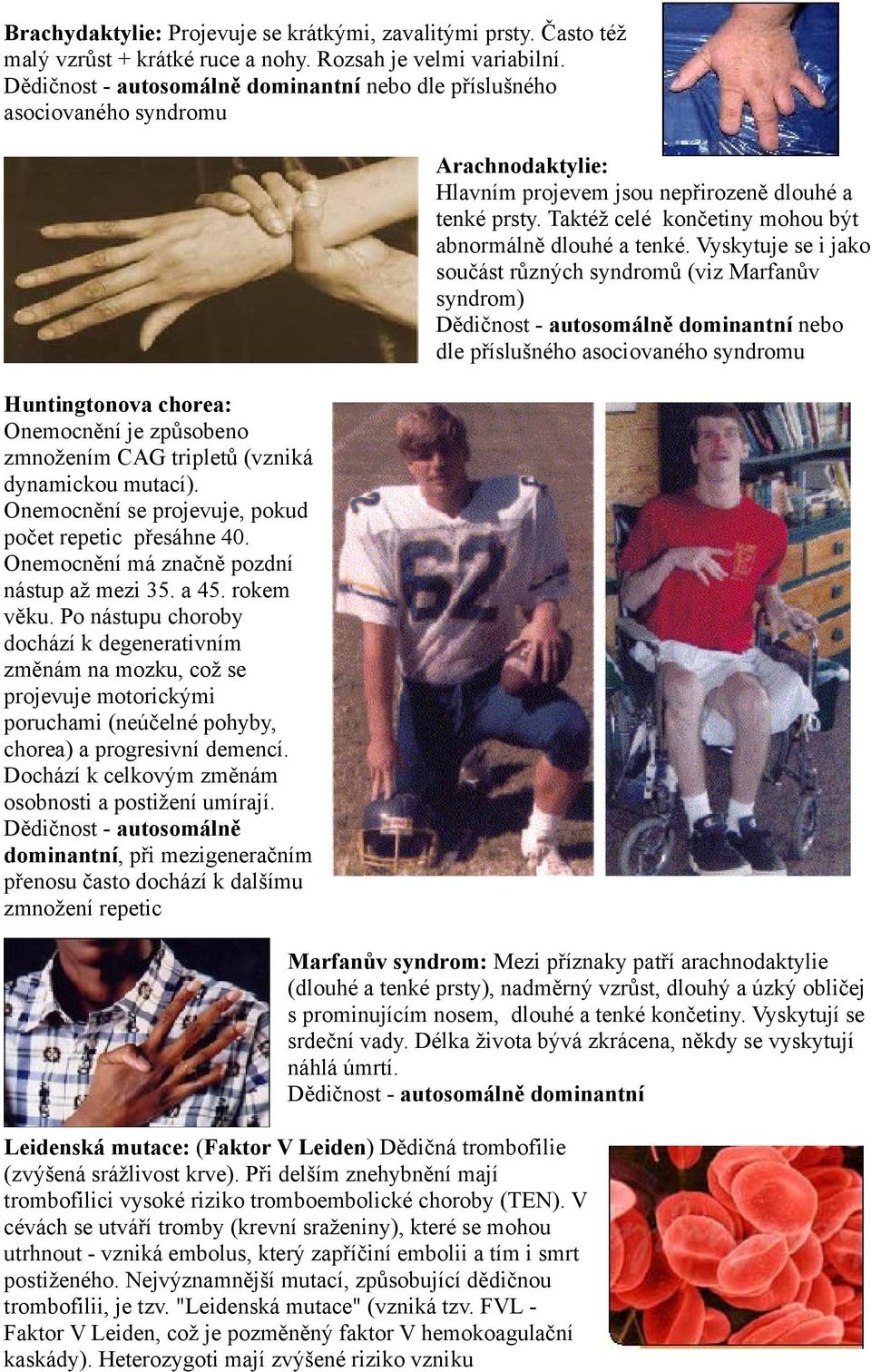 Onemocnění se projevuje, pokud počet repetic přesáhne 40. Onemocnění má značně pozdní nástup až mezi 35. a 45. rokem věku.