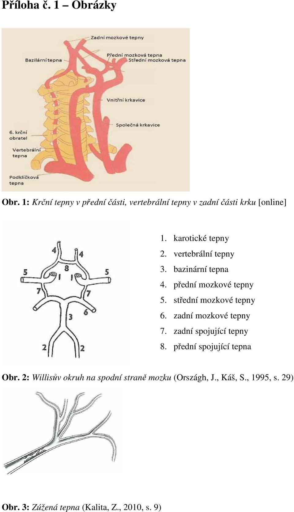 vertebrální tepny 3. bazinární tepna 4. přední mozkové tepny 5. střední mozkové tepny 6.