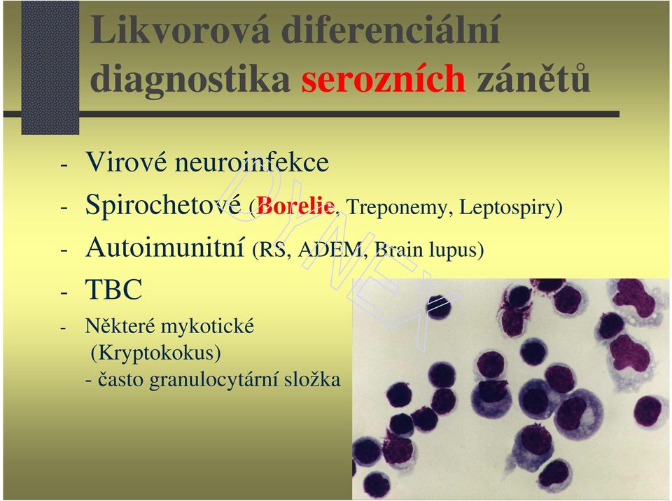 Leptospiry) - Autoimunitní (RS, ADEM, Brain lupus) - TBC