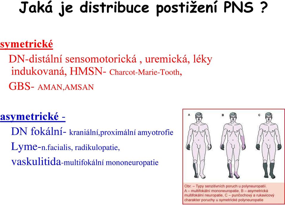 HMSN- Charcot-Marie-Tooth, GBS- AMAN,AMSAN asymetrické - DN