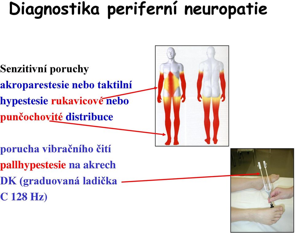 nebo punčochovité distribuce porucha vibračního čití