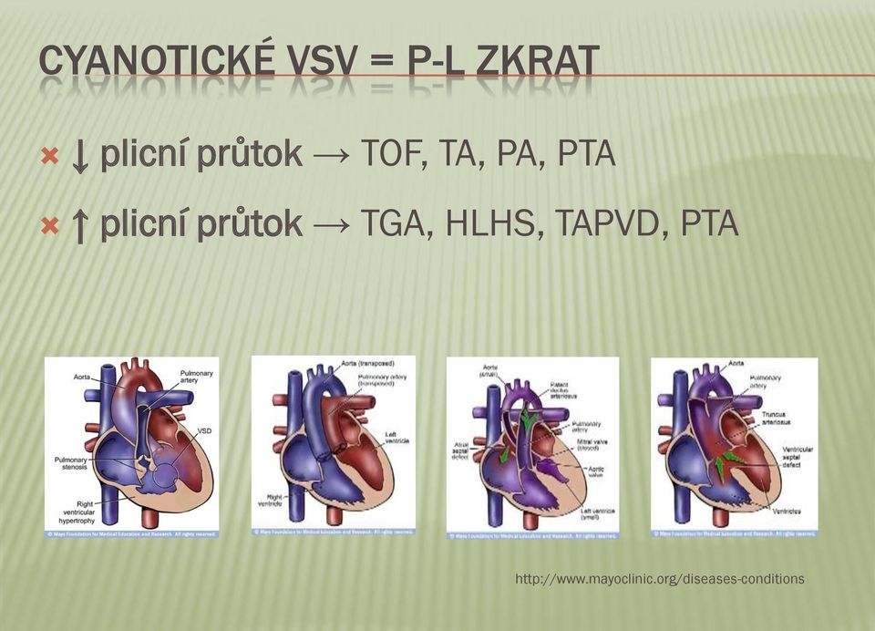 průtok TGA, HLHS, TAPVD, PTA