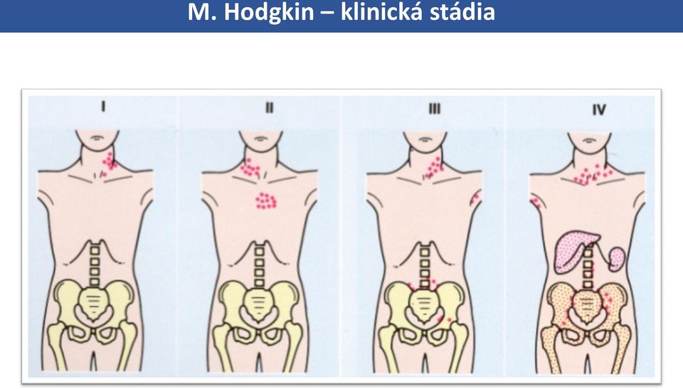 klinická