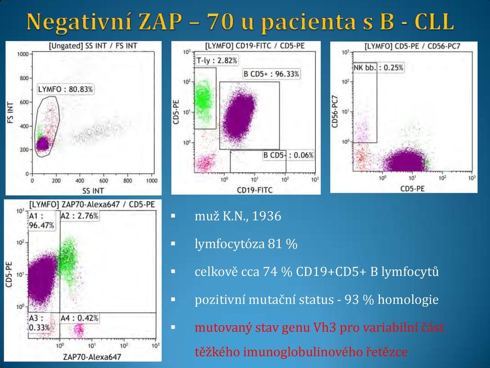 CD19+CD5+ B lymfocytů pozitivní mutační status