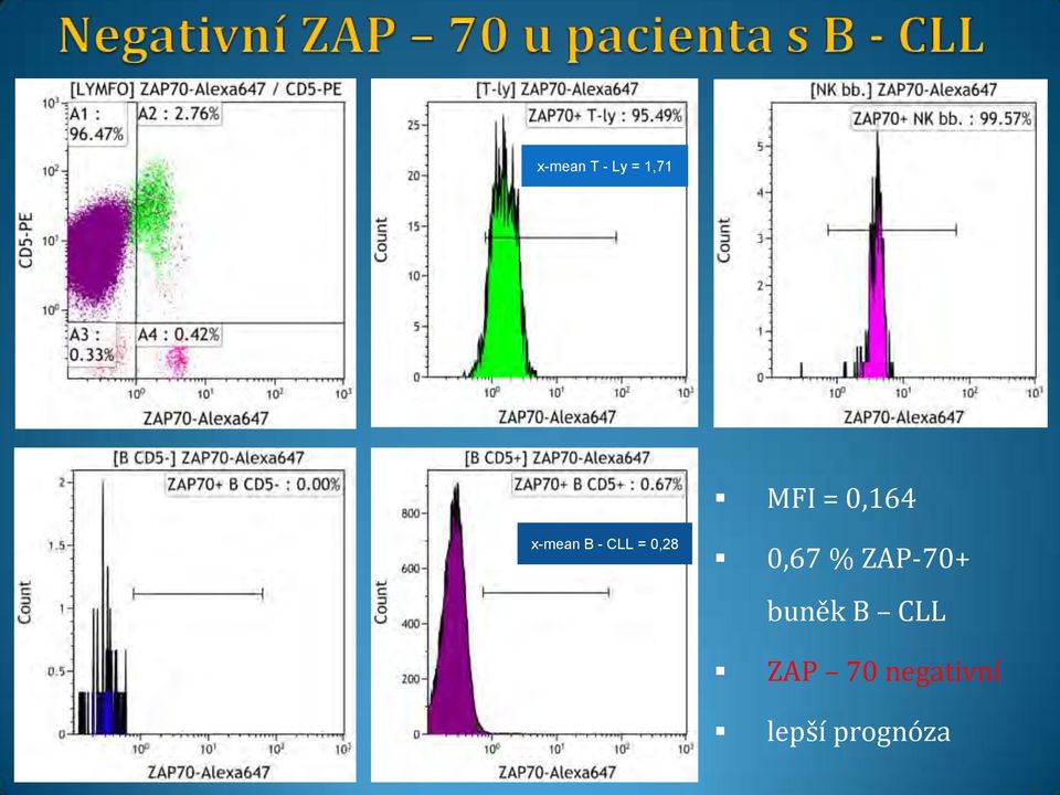 0,67 % ZAP-70+ buněk B CLL