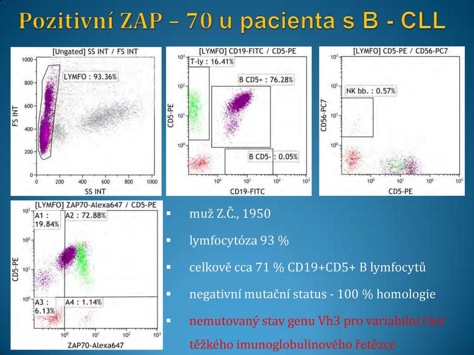 CD19+CD5+ B lymfocytů negativní mutační status -