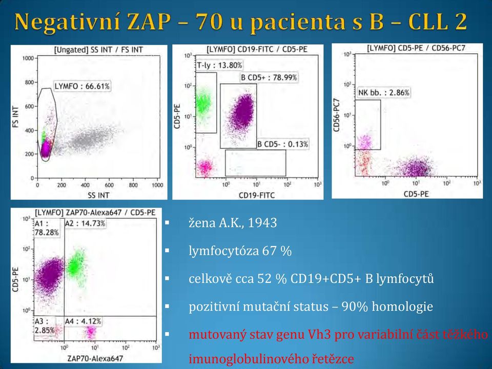 CD19+CD5+ B lymfocytů pozitivní mutační status