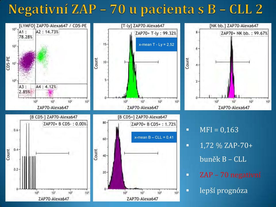 1,72 % ZAP-70+ buněk B CLL