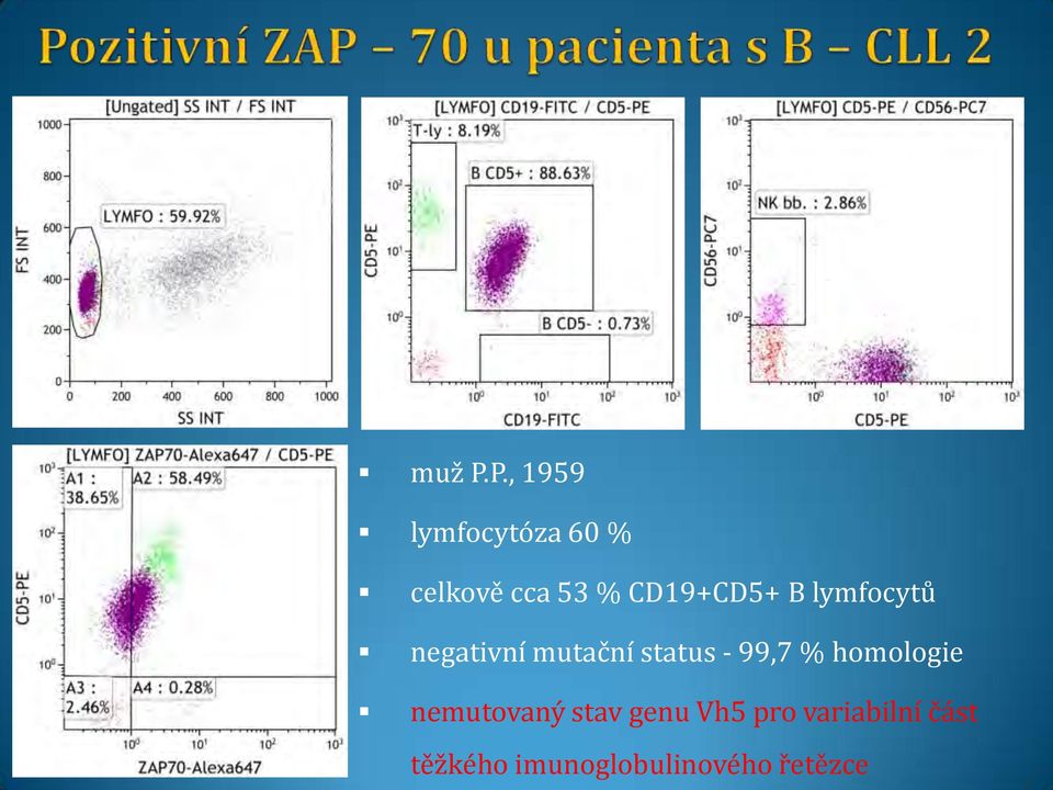 CD19+CD5+ B lymfocytů negativní mutační status -