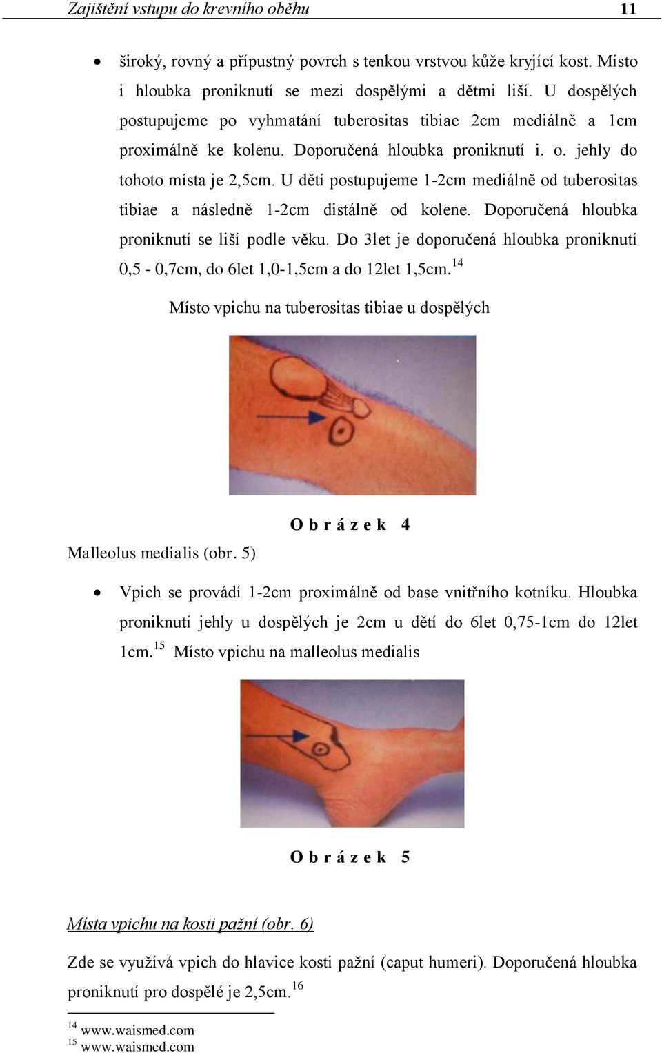 U dětí postupujeme 1-2cm mediálně od tuberositas tibiae a následně 1-2cm distálně od kolene. Doporučená hloubka proniknutí se liší podle věku.