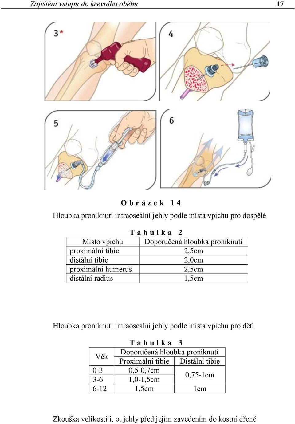 1,5cm Hloubka proniknutí intraoseální jehly podle místa vpichu pro děti T a b u l k a 3 Doporučená hloubka proniknutí Věk Proximální