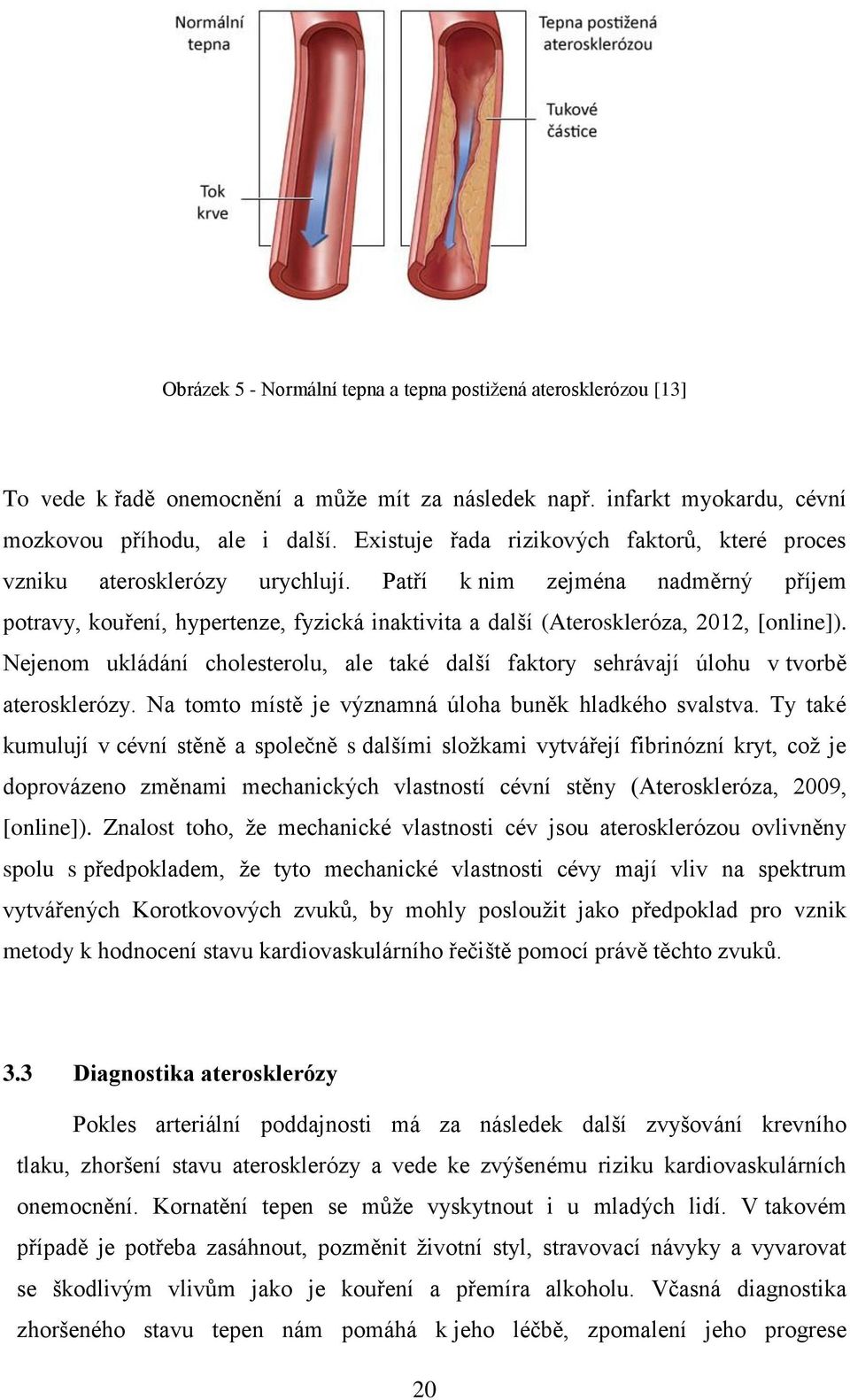 Patří k nim zejména nadměrný příjem potravy, kouření, hypertenze, fyzická inaktivita a další (Ateroskleróza, 2012, [online]).