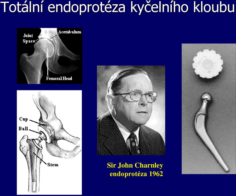 kyčelního kloubu