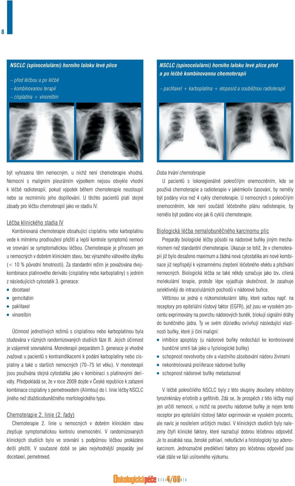 Nemocní s maligním pleurálním výpotkem nejsou obvykle vhodní k léčbě radioterapií, pokud výpotek během chemoterapie neustoupil nebo se nezmírnilo jeho doplňování.