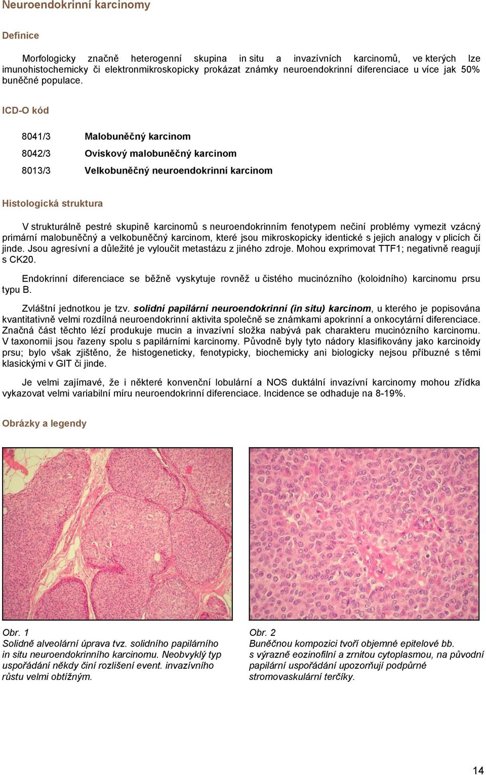 8041/3 Malobuněčný karcinom 8042/3 Ovískový malobuněčný karcinom 8013/3 Velkobuněčný neuroendokrinní karcinom Histologická struktura V strukturálně pestré skupině karcinomů s neuroendokrinním